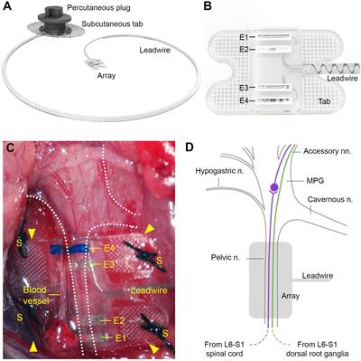 Recording of Electrically Evoked Neural Activity and Bladder Pressure Responses in Awake Rats Chronically Implanted With a Pelvic Nerve Array